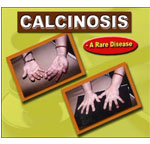 CALCINOSIS